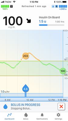 bolus_in_progress_stopping_bolus_on_mobile_pump_screen.png