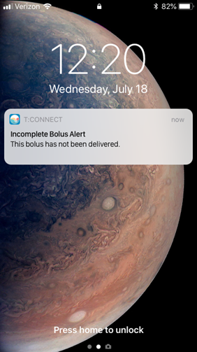 incomplete_bolus_alert_phone_notification.png