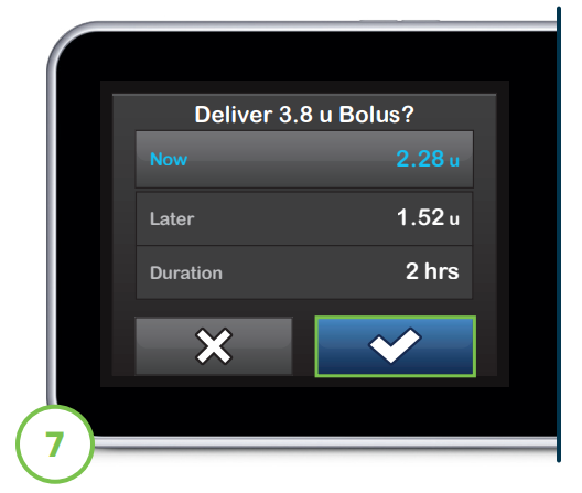 delivery_screen_to_confirm_the_amount_of_units_of_insulin_that_will_be_delivered_now__later__and_the_delivery_duration.png